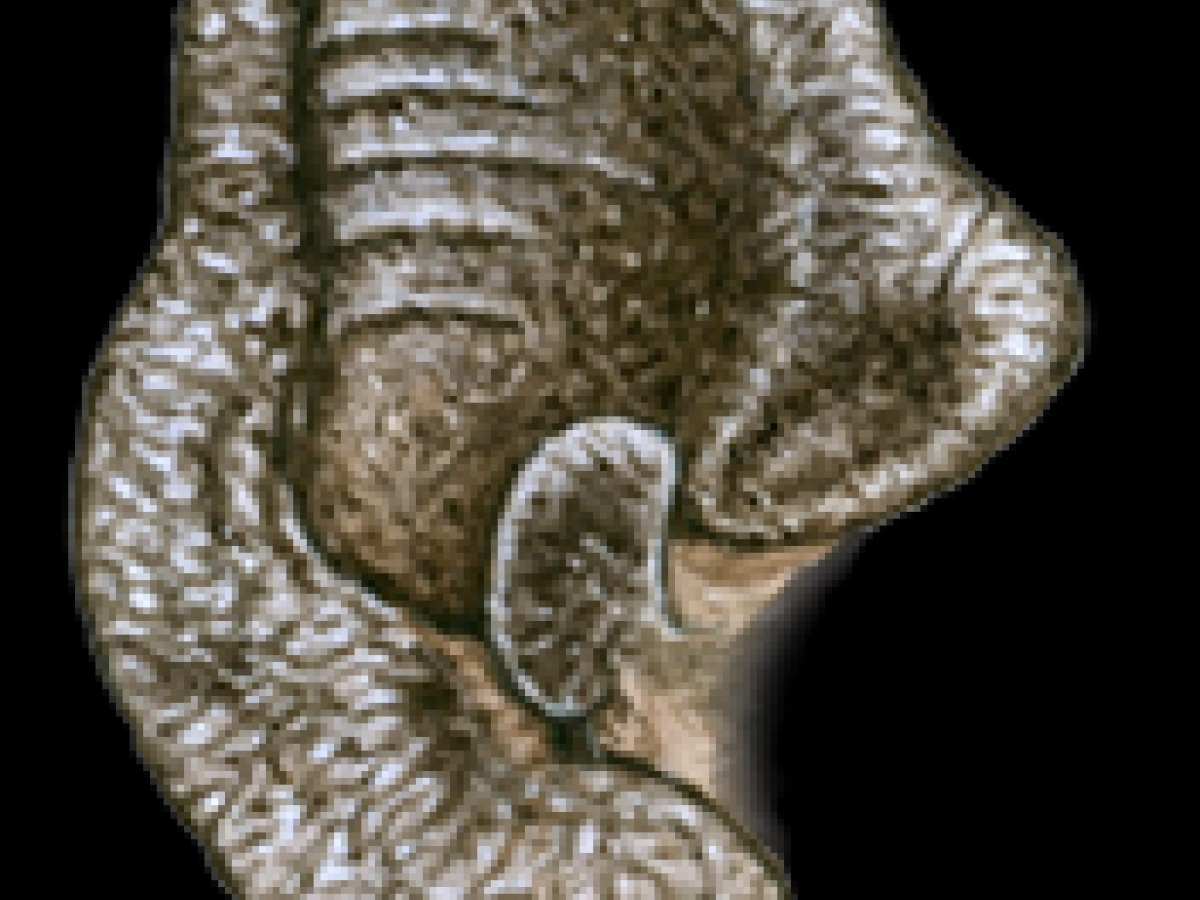 Oor en tragus. Peter Twisk