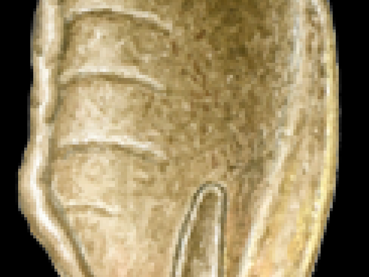 Oor met tragus. Peter Twisk